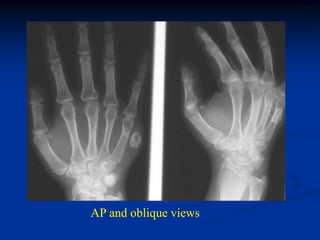 AP and oblique views
 
