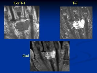 Cor T-1    T-2




     Gad
 