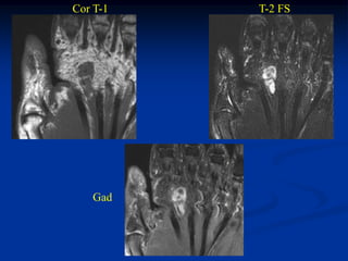 Cor T-1   T-2 FS




   Gad
 