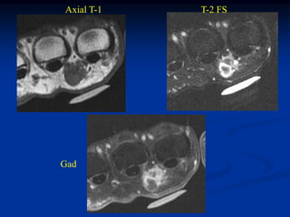 Axial T-1   T-2 FS




Gad
 