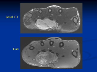 Axial T-1




     Gad
 
