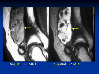 Sagittal T-1 MRI   Sagittal T-2 MRI
 