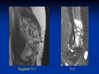 Sagittal T-1   T-2
 