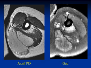 Axial PD   Gad
 