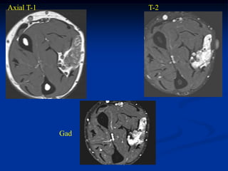 Axial T-1         T-2




            Gad
 