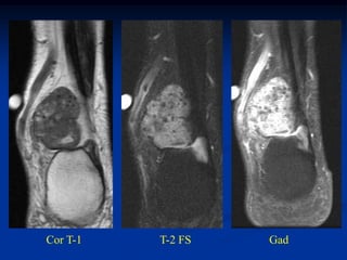 Cor T-1   T-2 FS   Gad
 