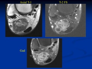 Axial T-1   T-2 FS




Gad
 