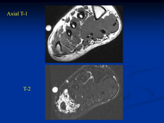 Axial T-1




       T-2
 