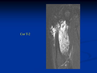 Cor T-2
 