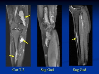 Cor T-2   Sag Gad   Sag Gad
 
