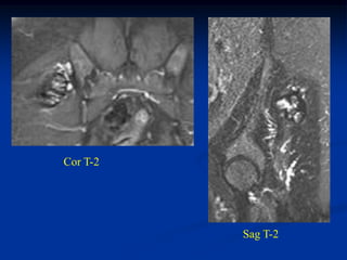 Cor T-2




          Sag T-2
 