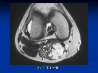 Axial T-1 MRI
 