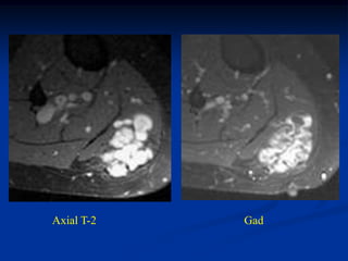 Axial T-2   Gad
 
