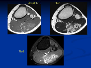 Axial T-1   T-2




Gad
 