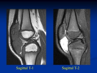 Sagittal T-1   Sagittal T-2
 