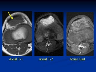 Axial T-1   Axial T-2   Axial Gad
 