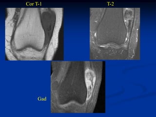 Cor T-1    T-2




     Gad
 