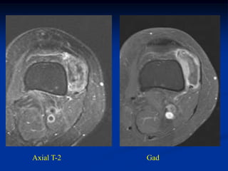 Axial T-2   Gad
 