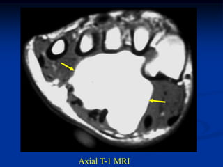 Axial T-1 MRI
 