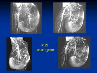 MRI
arteriogram
 