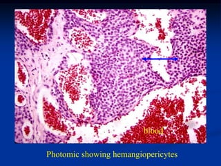 blood

Photomic showing hemangiopericytes
 