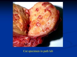 Cut specimen in path lab
 