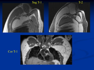 Sag T-1   T-2




Cor T-1
 