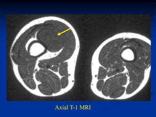 Axial T-1 MRI
 