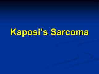Kaposi’s Sarcoma
 