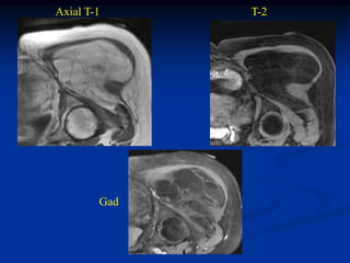 Axial T-1     T-2




        Gad
 