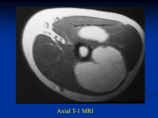 Axial T-1 MRI
 