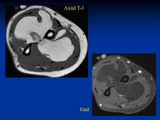 Axial T-1




       Gad
 