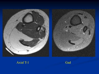 Axial T-1   Gad
 