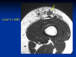 Axial T-1 MRI
 