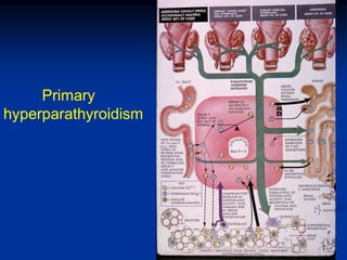 Primary
hyperparathyroidism
 