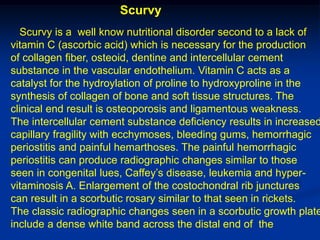 Scurvy
  Scurvy is a well know nutritional disorder second to a lack of
vitamin C (ascorbic acid) which is necessary for the production
of collagen fiber, osteoid, dentine and intercellular cement
substance in the vascular endothelium. Vitamin C acts as a
catalyst for the hydroylation of proline to hydroxyproline in the
synthesis of collagen of bone and soft tissue structures. The
clinical end result is osteoporosis and ligamentous weakness.
The intercellular cement substance deficiency results in increased
capillary fragility with ecchymoses, bleeding gums, hemorrhagic
periostitis and painful hemarthoses. The painful hemorrhagic
periostitis can produce radiographic changes similar to those
seen in congenital lues, Caffey’s disease, leukemia and hyper-
vitaminosis A. Enlargement of the costochondral rib junctures
can result in a scorbutic rosary similar to that seen in rickets.
The classic radiographic changes seen in a scorbutic growth plate
include a dense white band across the distal end of the
 