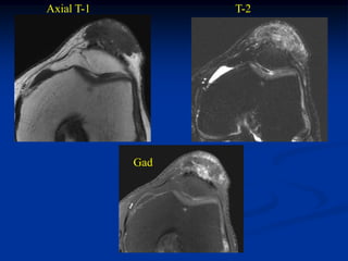 Axial T-1         T-2




            Gad
 