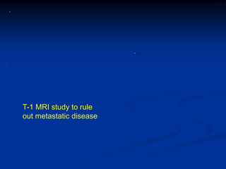 T-1 MRI study to rule
out metastatic disease
 
