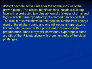 doesn’t become active until after the normal closure of the
growth plates. The clinical manifestations include a bull dog
face with a protruding jaw plus abnormal thickness of arms and
legs with soft tissue hypertrophy of enlarged hands and feet.
The skull x-rays will show an enlarged sell tursica from enlarge-
ment of the pituitary gland and one will notice a hyperostosis
frontalis interna along with a prominent external occipital
protuberance. Hand x-rays will show early hypertrophic osteo-
arthritis of the IP joints along with prominent tufts of the distal
phalanges.
 