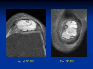 Axial PD FS   Cor PD FS
 