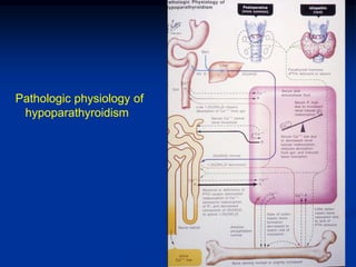 Pathologic physiology of
 hypoparathyroidism
 