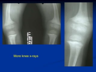 More knee x-rays
 