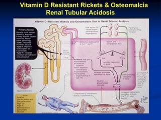 Vitamin D Resistant Rickets & Osteomalcia
        Renal Tubular Acidosis
 