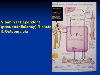 Vitamin D Dependent
(pseudodeficiency) Rickets
& Osteomalcia
 