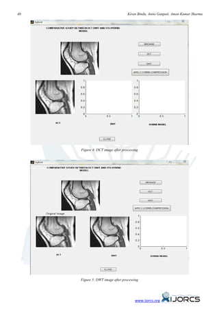 40                                Kiran Bindu, Anita Ganpati, Aman Kumar Sharma




     Figure 4: DCT image after processing




     Figure 5: DWT image after processing




                                       www.ijorcs.org
 