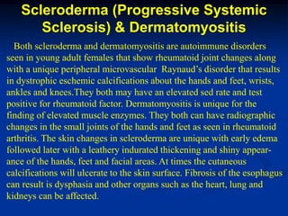 Vol 25 arthritis | PDF