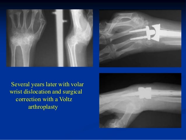 Bluboo x ray 25 yr ild neck