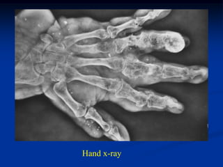 Hand x-ray
 