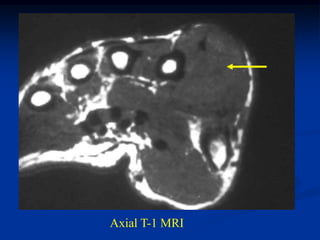 Axial T-1 MRI
 