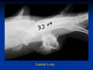 Lateral x-ray
 